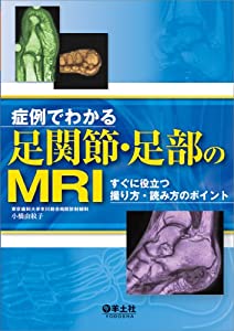 症例でわかる足関節・足部のMRI?すぐに役立つ撮り方・読み方のポイント(中古品)