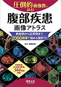 圧倒的画像数で診る! 腹部疾患画像アトラス?典型例から応用例まで、2000画像で極める読影力!(中古品)