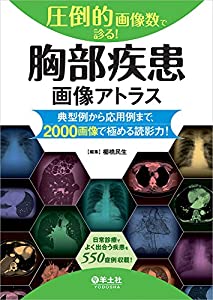 圧倒的画像数で診る! 胸部疾患画像アトラス?典型例から応用例まで、2000画像で極める読影力!(中古品)