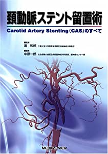 頚動脈ステント留置術?Carotid Artery Stenting(CAS)のすべて(中古品)