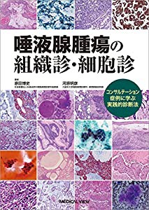 唾液腺腫瘍の組織診・細胞診?コンサルテーション症例に学ぶ実践的診断法(中古品)