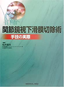 関節鏡視下滑膜切除術—手技の実際(中古品)