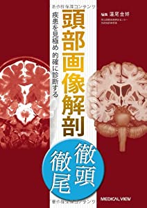 頭部画像解剖 徹頭徹尾—疾患を見極め的確に診断する(中古品)
