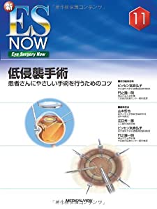 低侵襲手術 (新ES Now No. 11)(中古品)