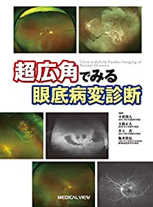 超広角でみる眼底病変診断?病巣を見逃さないために(中古品)
