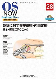 骨折に対する整復術・内固定術?安全・確実なテクニック (OS NOW Instruction)(中古品)