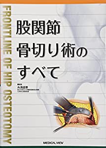 股関節骨切り術のすべて(中古品)の通販は