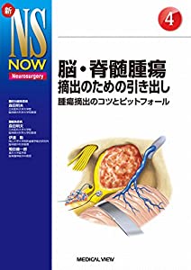 脳・脊髄腫瘍摘出のための引き出し?腫瘍摘出のコツとピットフォール (新NS NOW 4)(中古品)