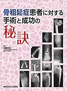 骨粗鬆症患者に対する手術と成功の秘訣(中古品)