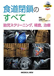 食道閉鎖のすべて?胎児スクリーニング  精査  治療(中古品)