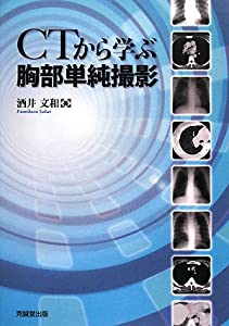 CTから学ぶ胸部単純撮影(中古品)