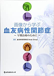 画像から学ぶ血友病性関節症—~早期治療のために~(中古品)