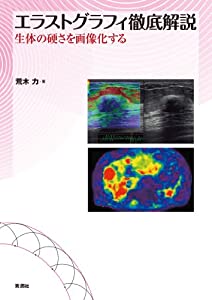 エラストグラフィ徹底解説: 生体の硬さを画像化する(中古品)の通販は