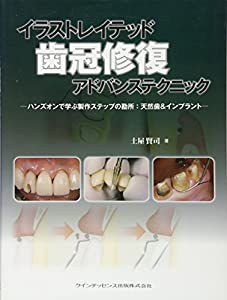 中古】 マイ・オンリー・ワン 1980年代 （ハーレクイン
