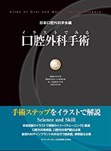 イラストでみる口腔外科手術 第3巻(中古品)
