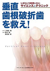 いざという時使いたいサイエンス&テクニック 垂直歯根破折歯を救え!(中古品)の通販はその他本・コミック・雑誌