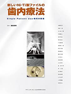 新しいNi-Ti製ファイルの歯内療法(中古品)の通販は