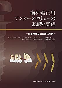 歯科改心させる用船がかり推進器の基本原則と当て嵌める(中古品)