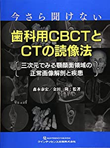 今さら聞けない歯科用CBCTとCTの読像法(中古品)の通販は 11,624円