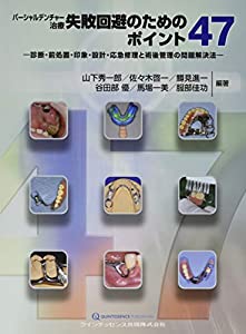 パーシャルデンチャー治療 失敗回避のためのポイント47(中古品)の通販は 15,045円