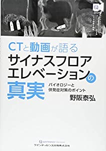 CTと動画が語る サイナスフロアエレベーションの真実(中古品)