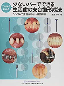 これならわかる 少ないバーでできる生活歯の支台歯形成法(中古品)