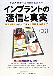 インプラントの迷信と真実 (迷信と真実シリーズ)(中古品)
