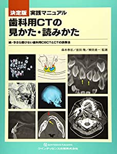 決定版 実践マニュアル 歯科用CTの見かた・読みかた(中古品)の通販は