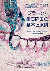 プラーク・歯石除去の基本と原則(中古品)