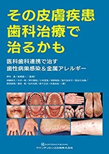 その皮膚疾患 歯科治療で治るかも(中古品)