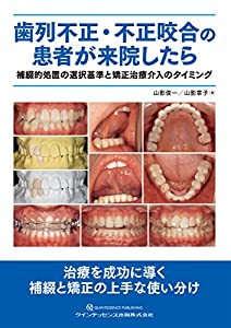 歯列不正・不正咬合の患者が来院したら(中古品)
