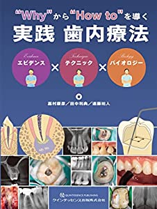 “Whyから“How toを導く実践 歯内療法(中古品) 12,960円