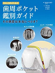 DHとDRのための歯周ポケット鑑別ガイド(中古品)
