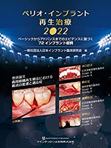 ペリオ・インプラント再生治療 2022(中古品)