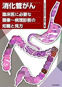 消化管がん—臨床医に必要な画像 病理診断の知識と見方(中古品)の通販は