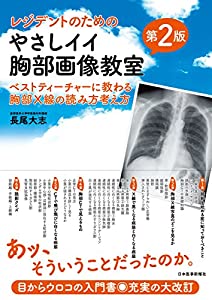 レジデントのためのやさしイイ胸部画像教室[ベストティーチャーに教わる胸部X線の読み方考え方] 改訂第2版(中古品)