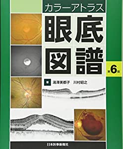カラーアトラス　眼底図譜(中古品)の通販は