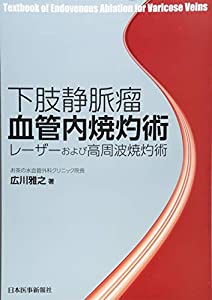 下肢静脈瘤血管内焼灼術(中古品)