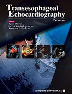 Transesophageal Echocardiography(中古品)