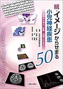 続・イメージからせまる小児神経疾患50—症例から学ぶ 診断・治療プロセス—(中古品)の通販は
