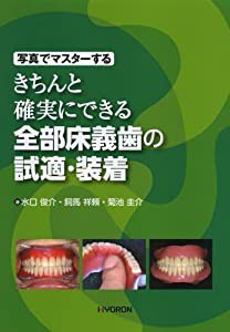写真でマスターする きちんと確実にできる全部床義歯の試適・装着(中古品)の通販は