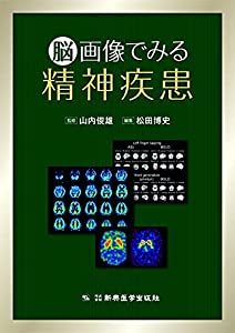 脳画像でみる精神疾患(中古品)