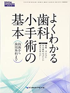 よくわかる歯科小手術の基本—抜歯から歯周外科まで(中古品)