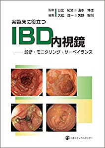 実臨床に役立つIBD内視鏡(中古品)の通販は