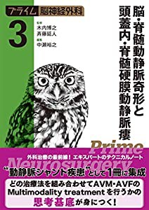 プライム脳神経外科3 脳・脊髄動静脈奇形と頭蓋内・脊髄硬膜動静脈瘻(中古品)の通販は