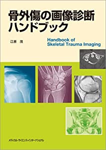 骨外傷の画像診断ハンドブック(中古品)