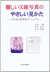 難しいX線写真のやさしい見かた—口内法X線解剖マニュアル(中古品)