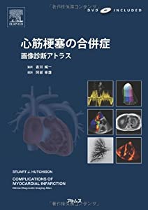 心筋梗塞の合併症　画像診断アトラス　DVD付き(中古品)