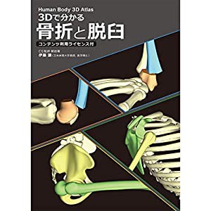 3Dで分かる 骨折と脱臼 コンテンツ利用ライセンス付(中古品)