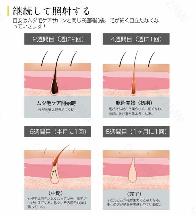 脱毛器 家庭用脱毛器 光 背中 ipl セルフ脱毛 フラッシュ式 IPL 光美容